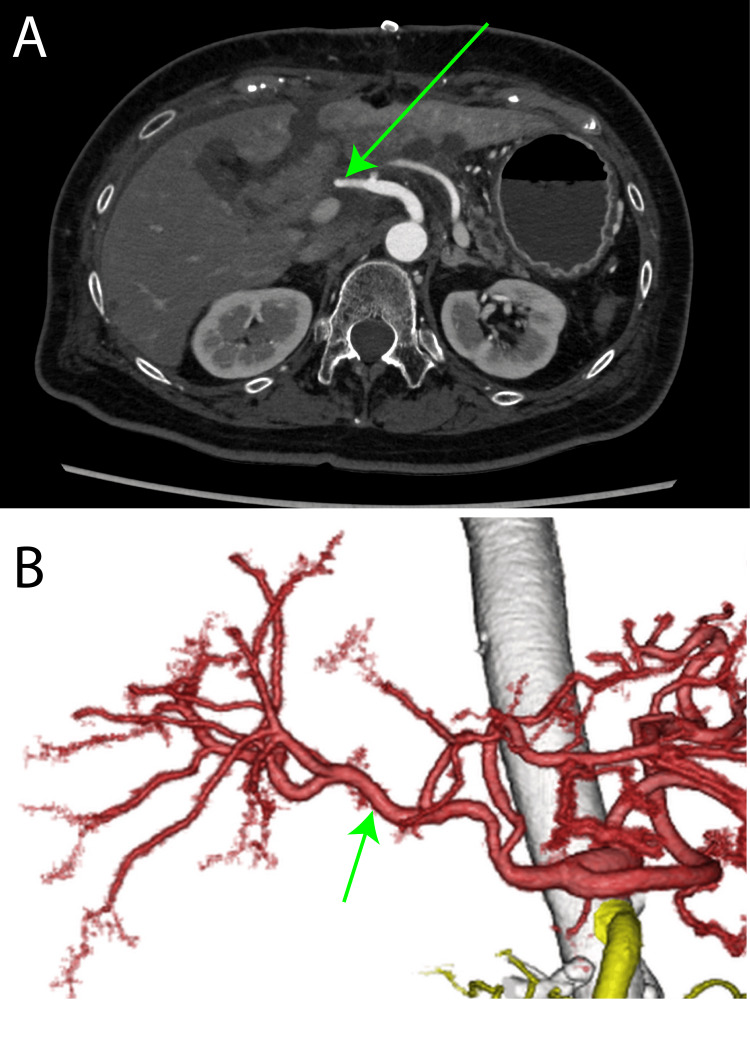 Figure 5