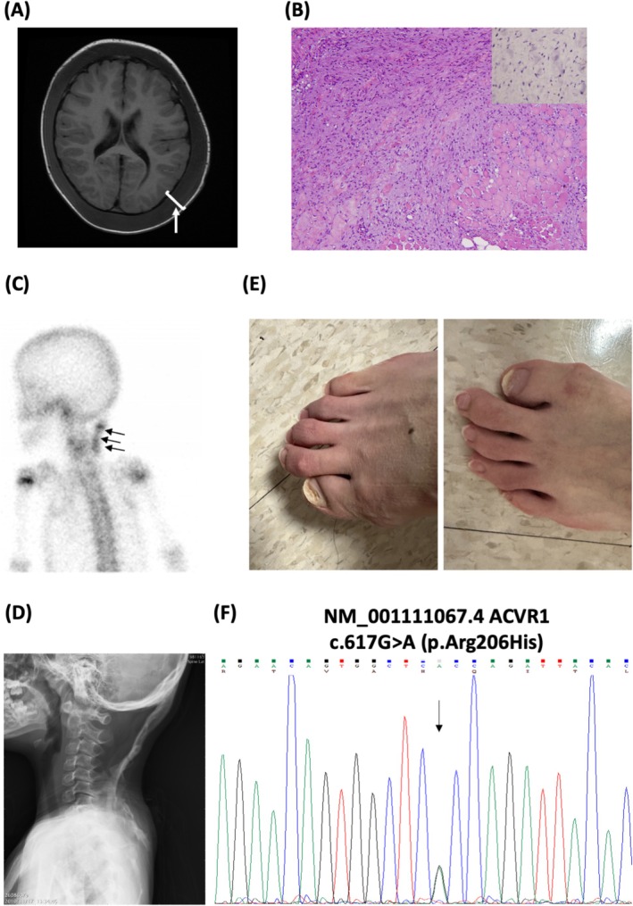 FIGURE 1