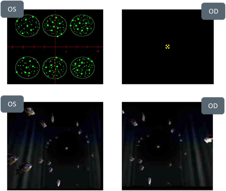 Fig 1