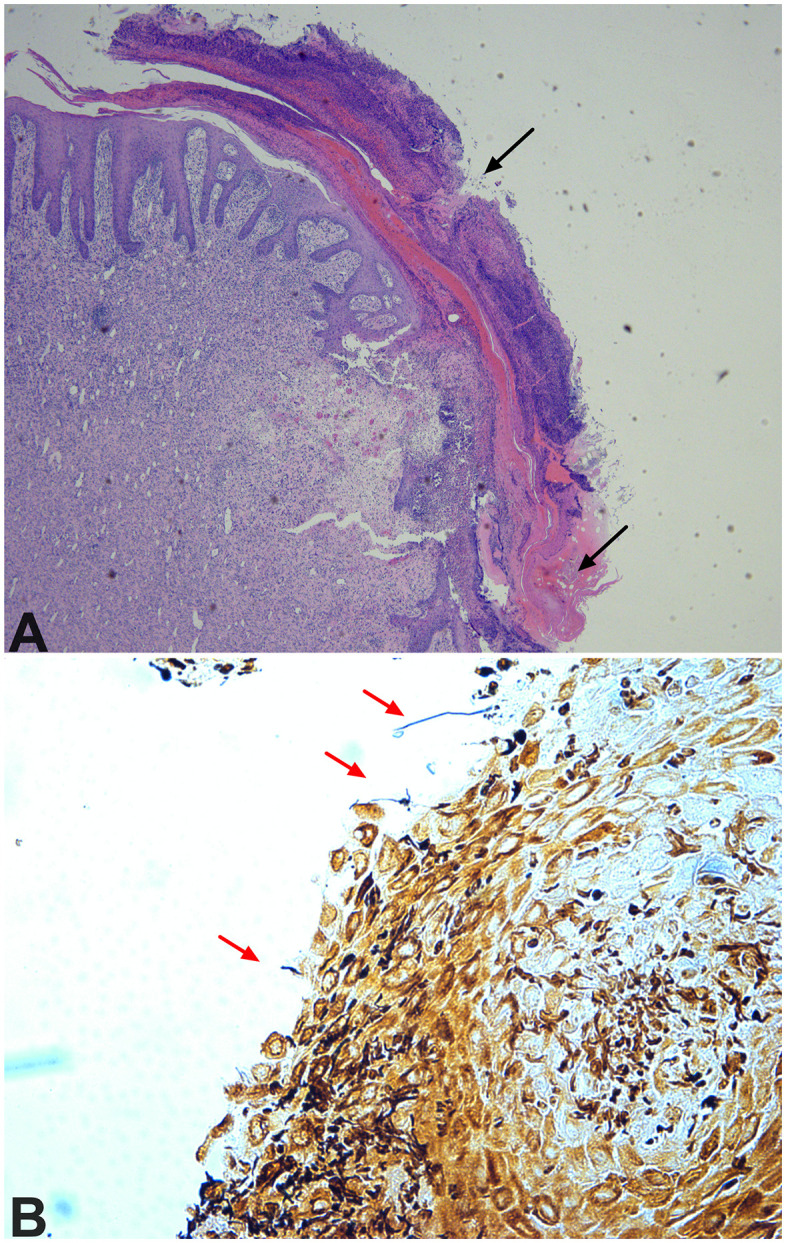 Fig 6