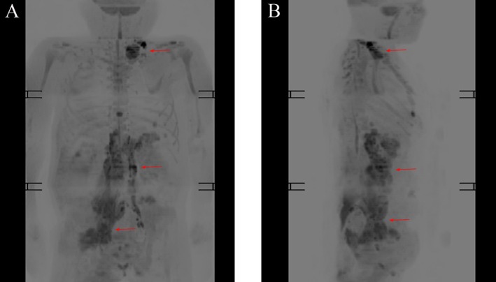 FIGURE 1