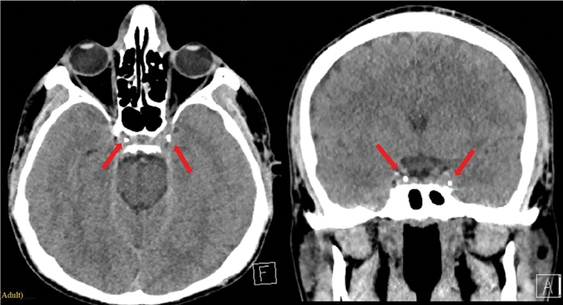 Fig. 3