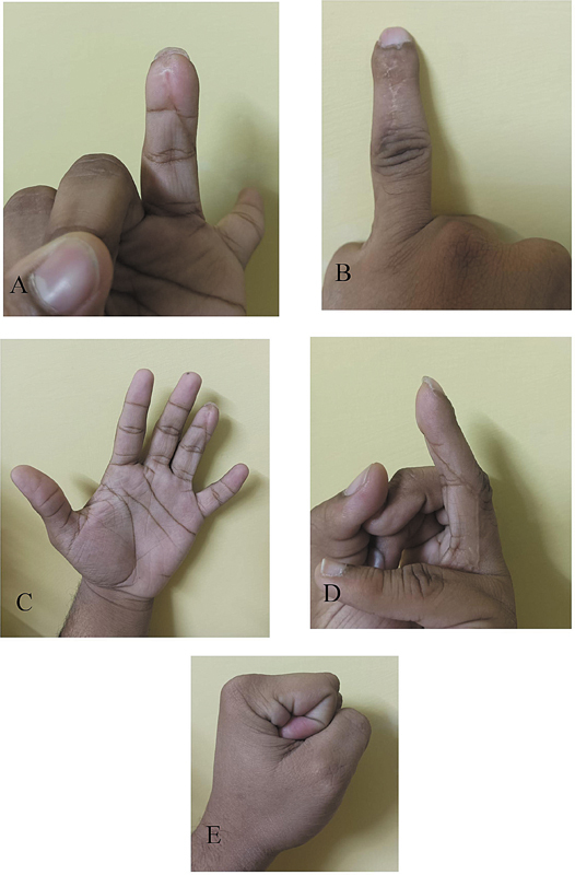 Fig. 6