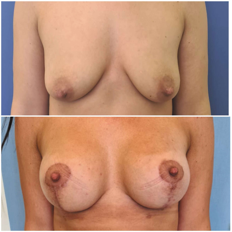 Fig. 6