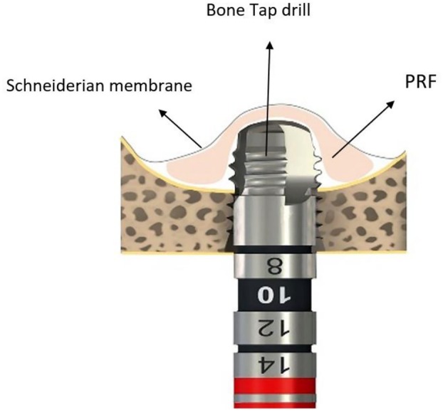 FIGURE 2