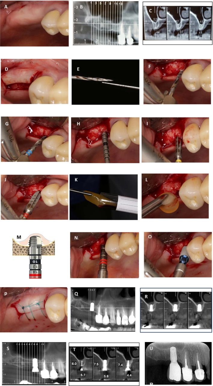 FIGURE 3