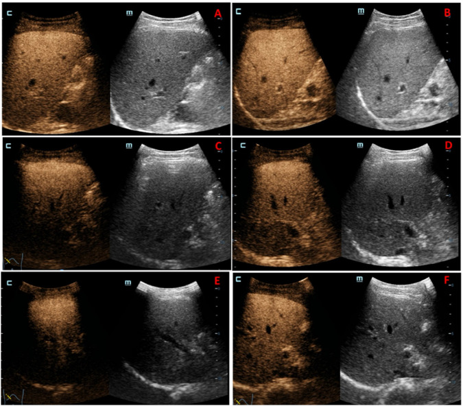FIGURE 4