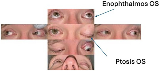 Figure 1