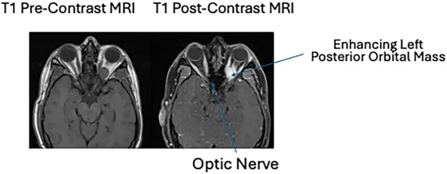 Figure 2