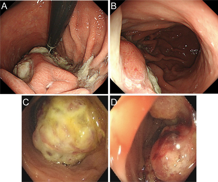 Figure 2