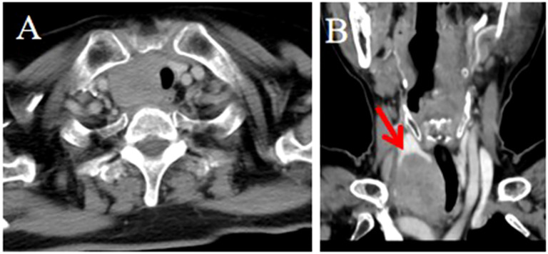 Figure 2