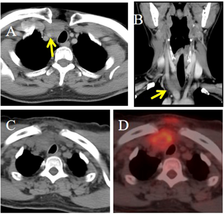 Figure 4