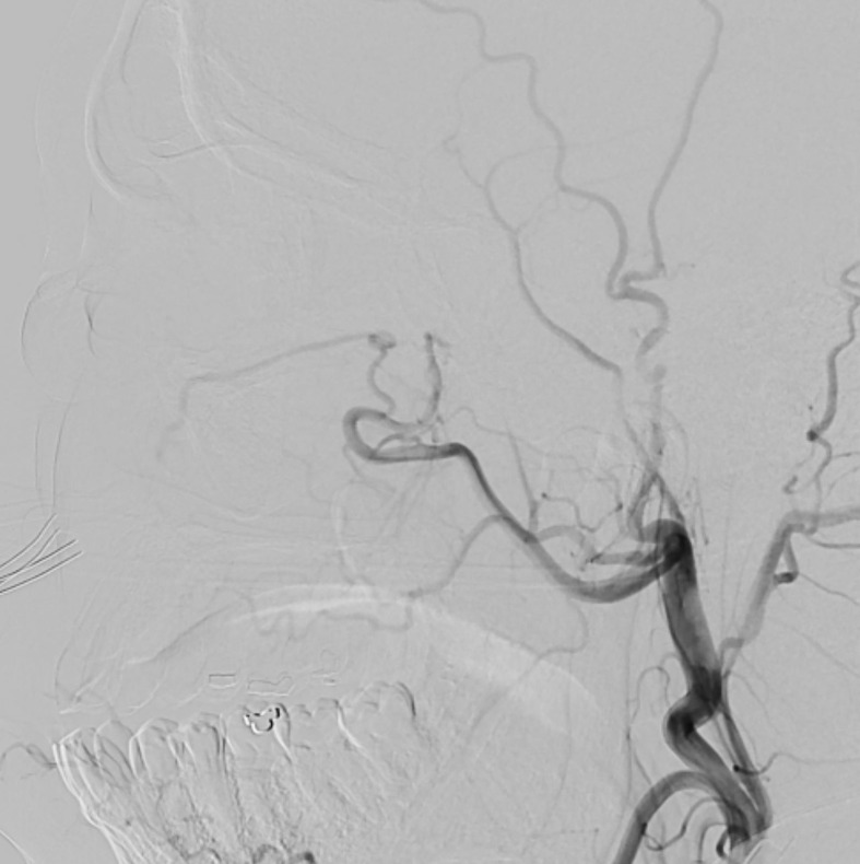 Figure 4