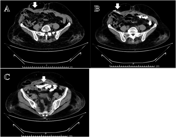 FIGURE 1