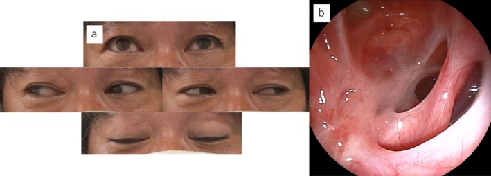 FIGURE 4