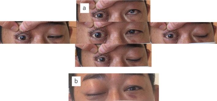 FIGURE 1