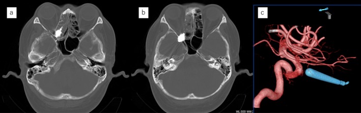 FIGURE 2