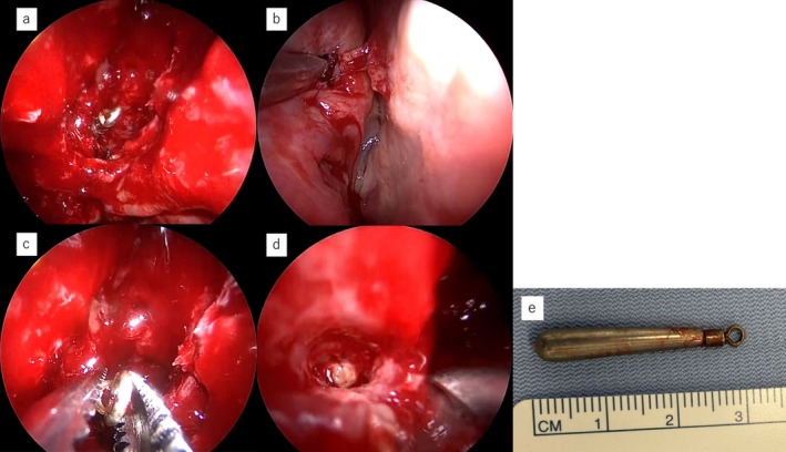 FIGURE 3