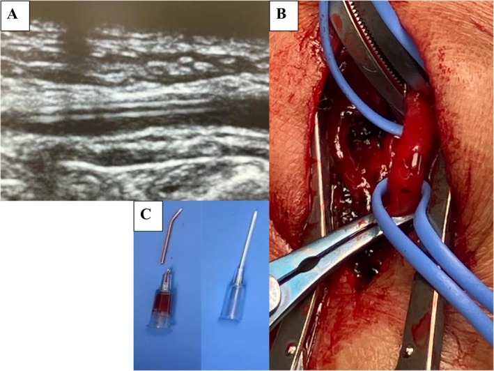 FIGURE 1