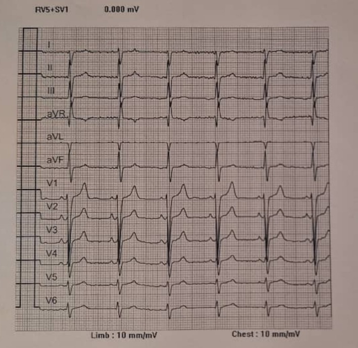 FIGURE 1
