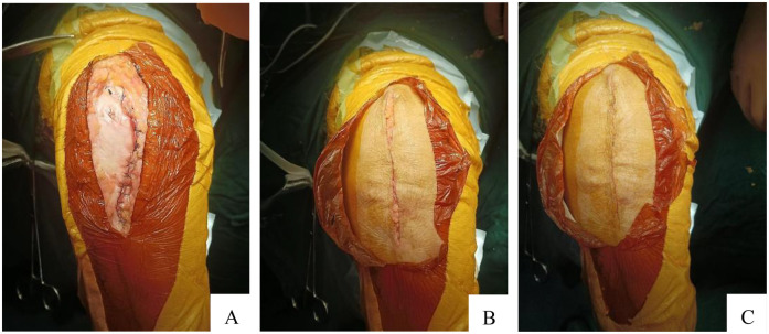 Figure 3