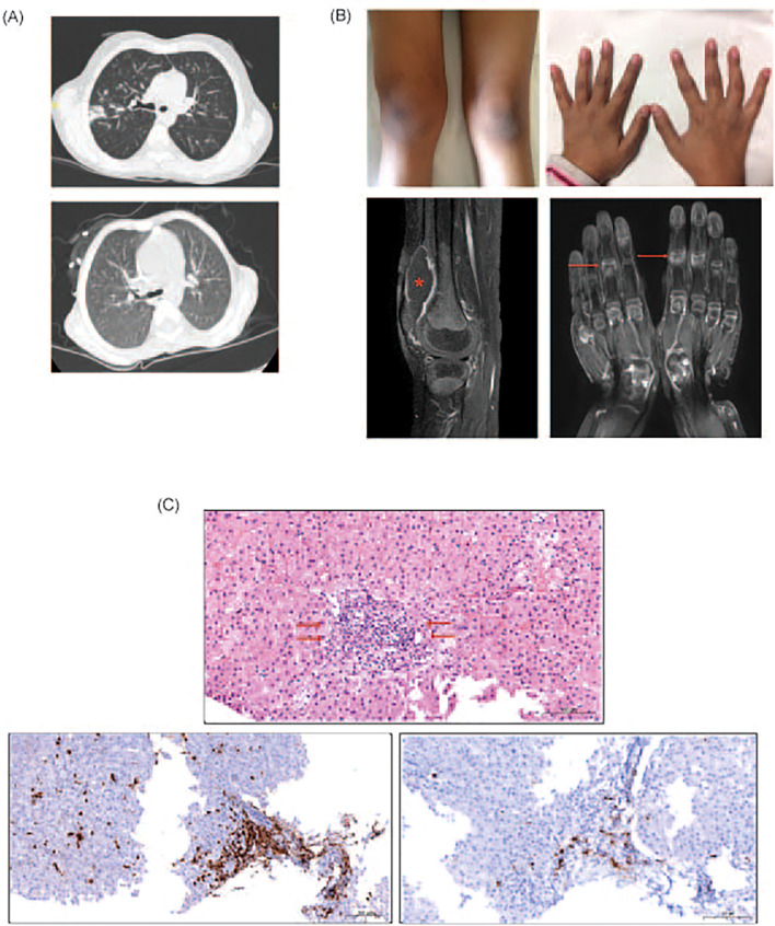 Figure 1