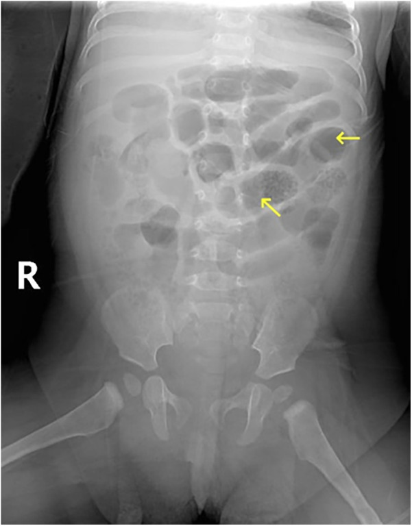 Figure 2