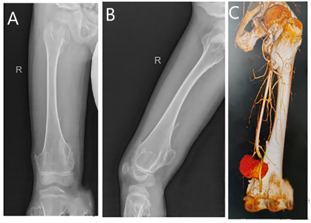 Figure 1