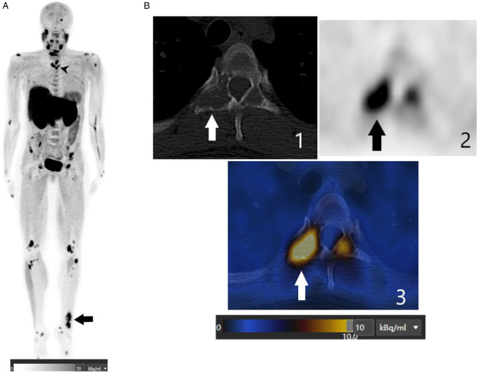 Figure 1
