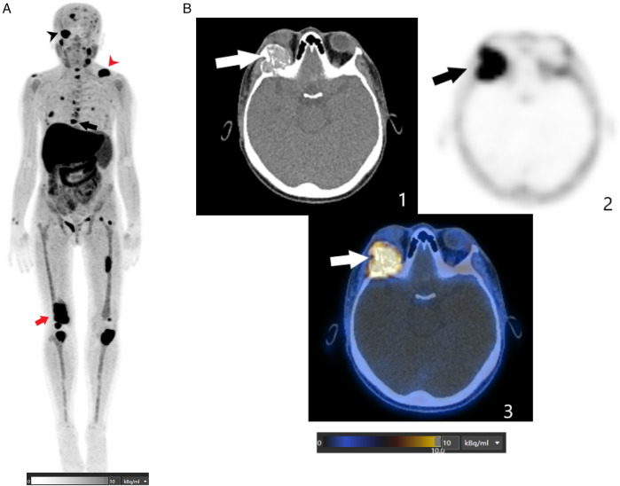 Figure 2