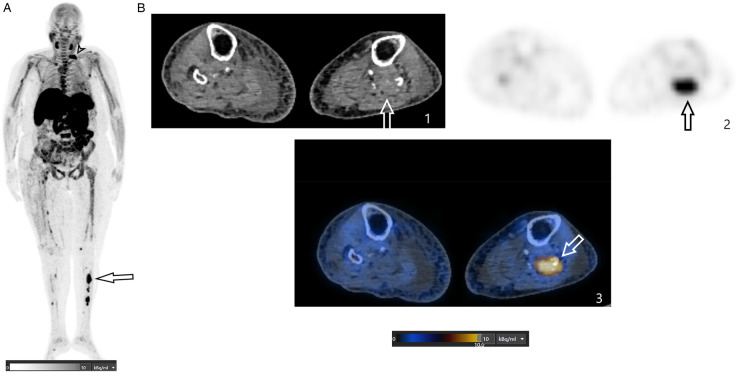 Figure 3