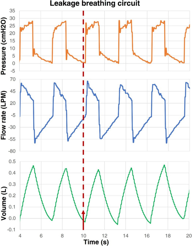 Figure 12