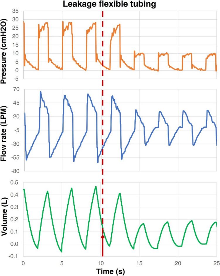 Figure 13