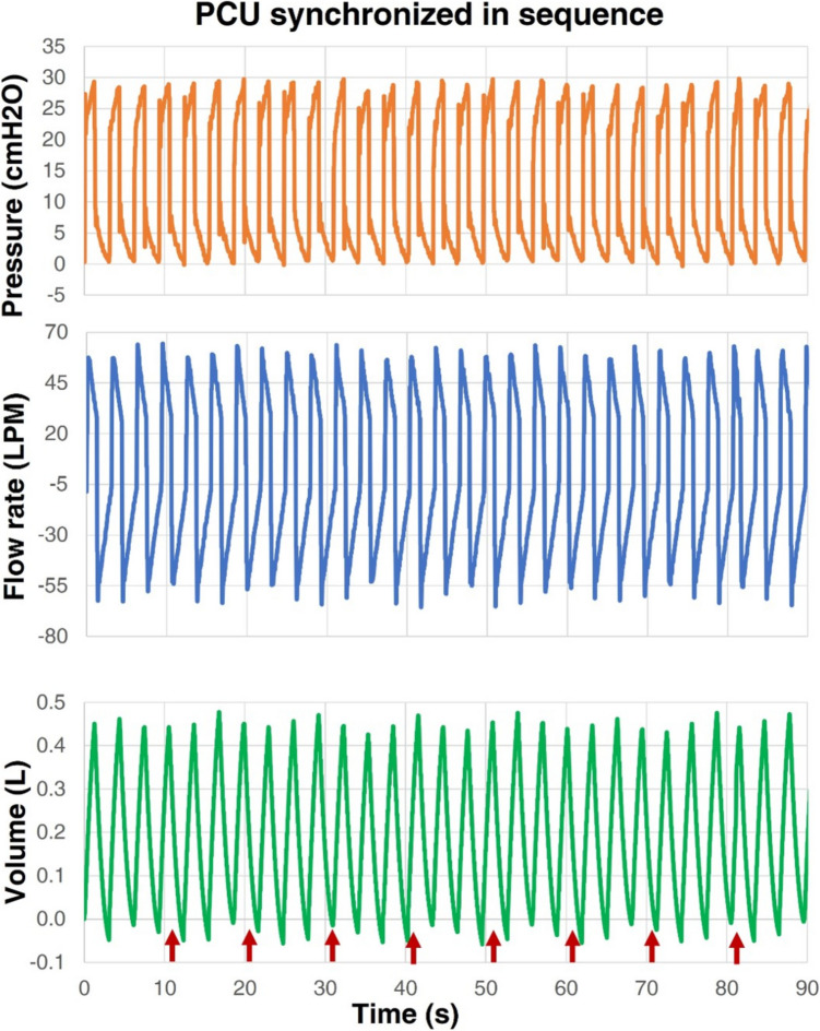 Figure 14