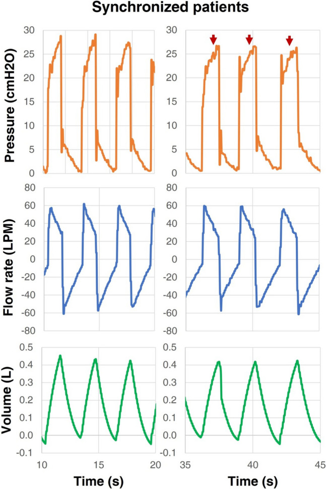 Figure 15