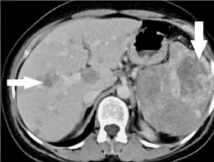 Figure 11