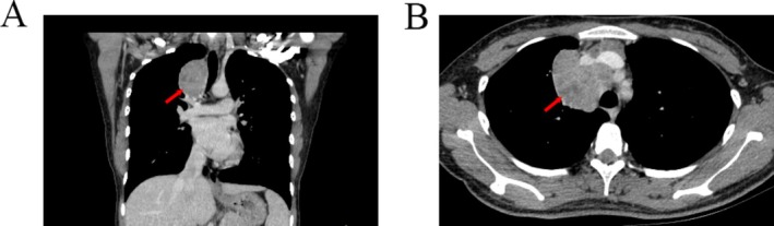 FIGURE 1
