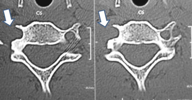 Figure 6