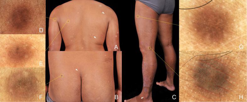 Figure 2