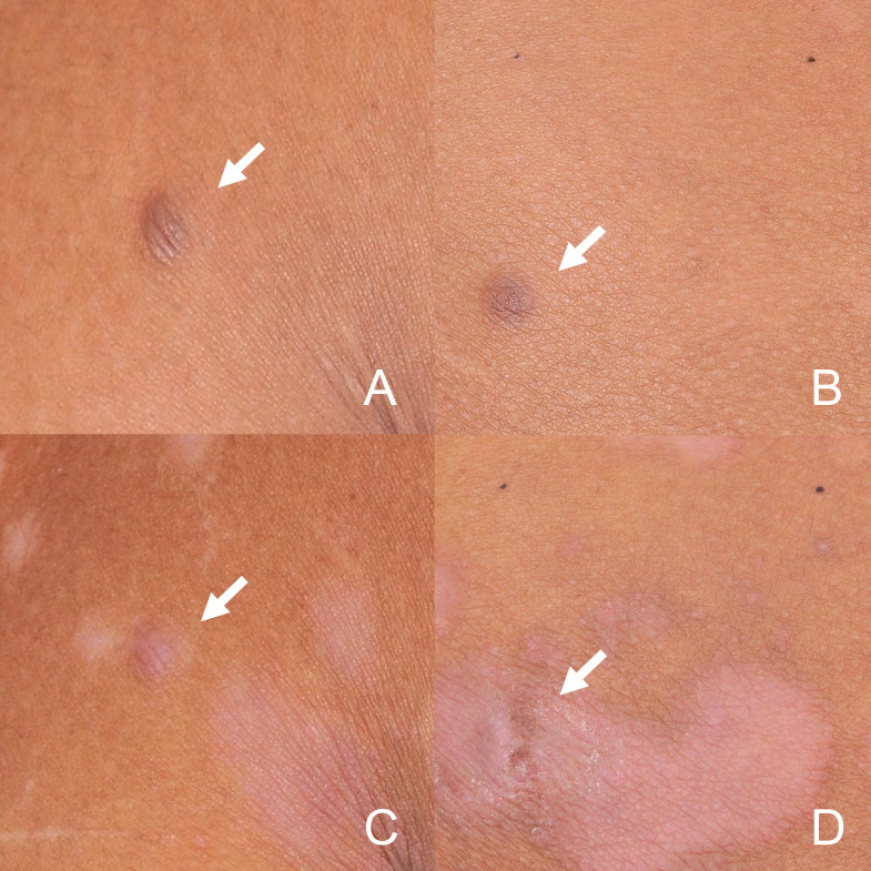Figure 4