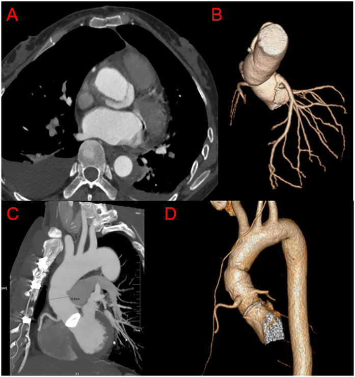 Figure 4