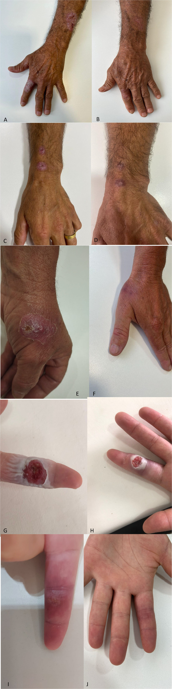 Fig 3
