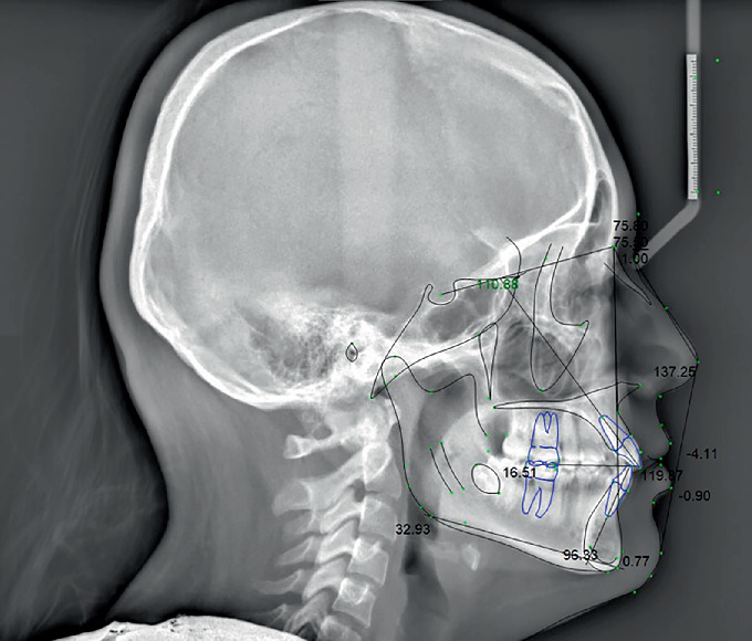 Figure 11
