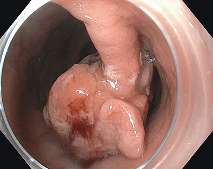 Fig. 1