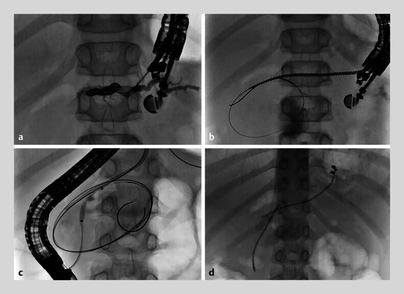 Fig. 4