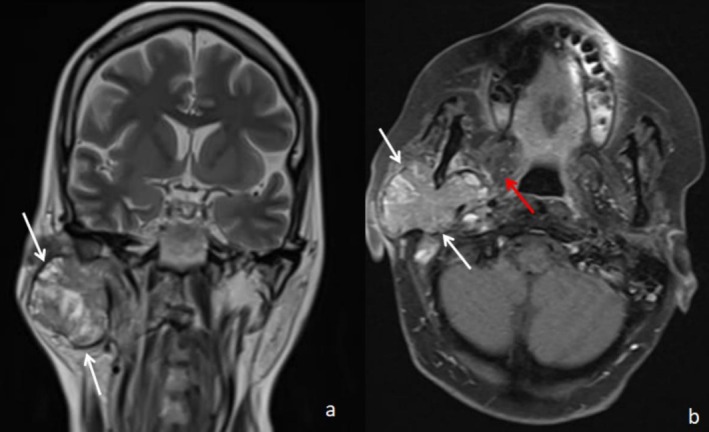 FIGURE 1