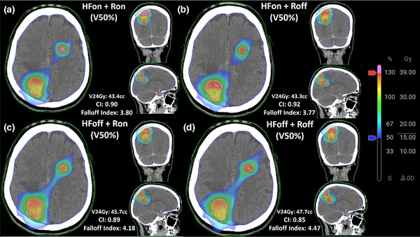 FIGURE 2