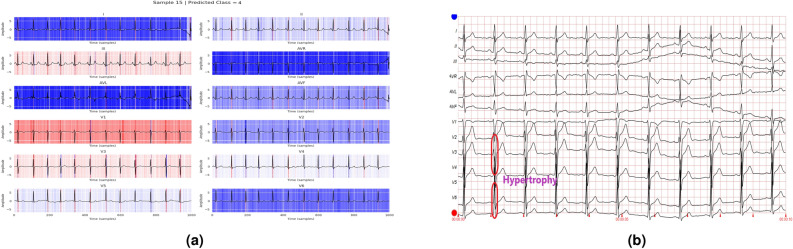 Figure 17