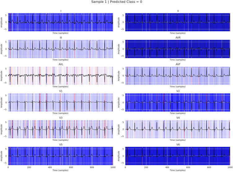 Figure 18