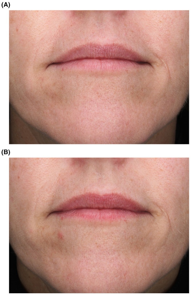 FIGURE 3